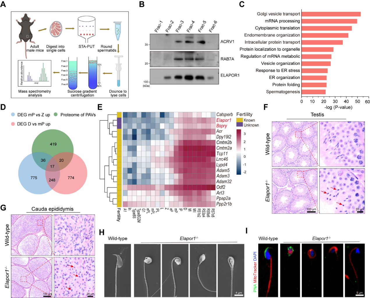 20250806-PNAS -王凤超郑三多-1.Elapor1对雄性小鼠的精子发生至关重要.png